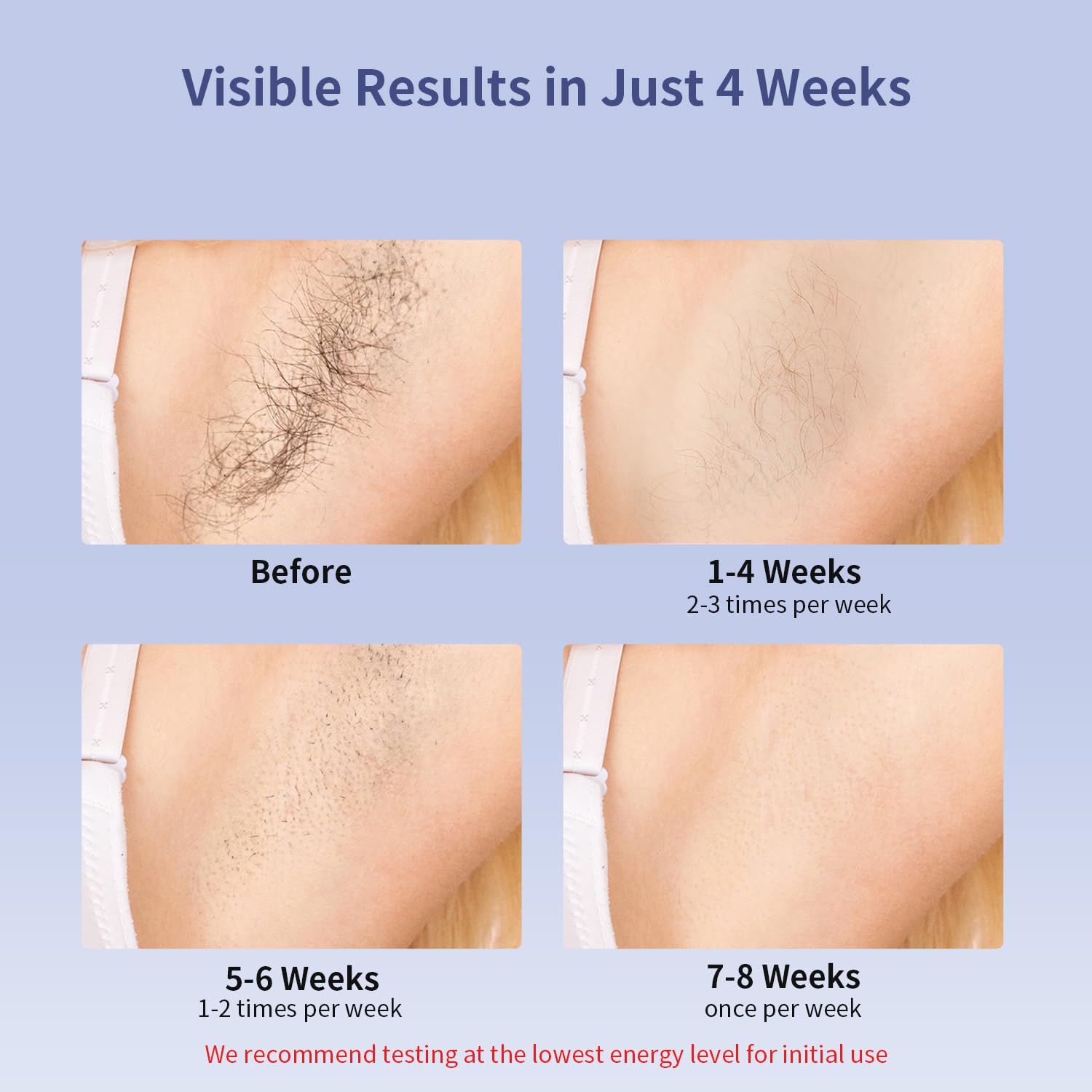 MLAY IPL Laser Hair Removal, Hair Removal Device with Ice Cooling Painless Hair Removal for Women & Men, Permanent Hair Removal at Home for Arms Armpits Face Legs Bikini Line, 5 Energy Levels, 2 Heads | T14 Hair Removal 1,500,000 Flashes Permanent Hair Removal at Home for Arms Armpits Face Legs Bikini Line, with HR BK FC Heads - Image 4