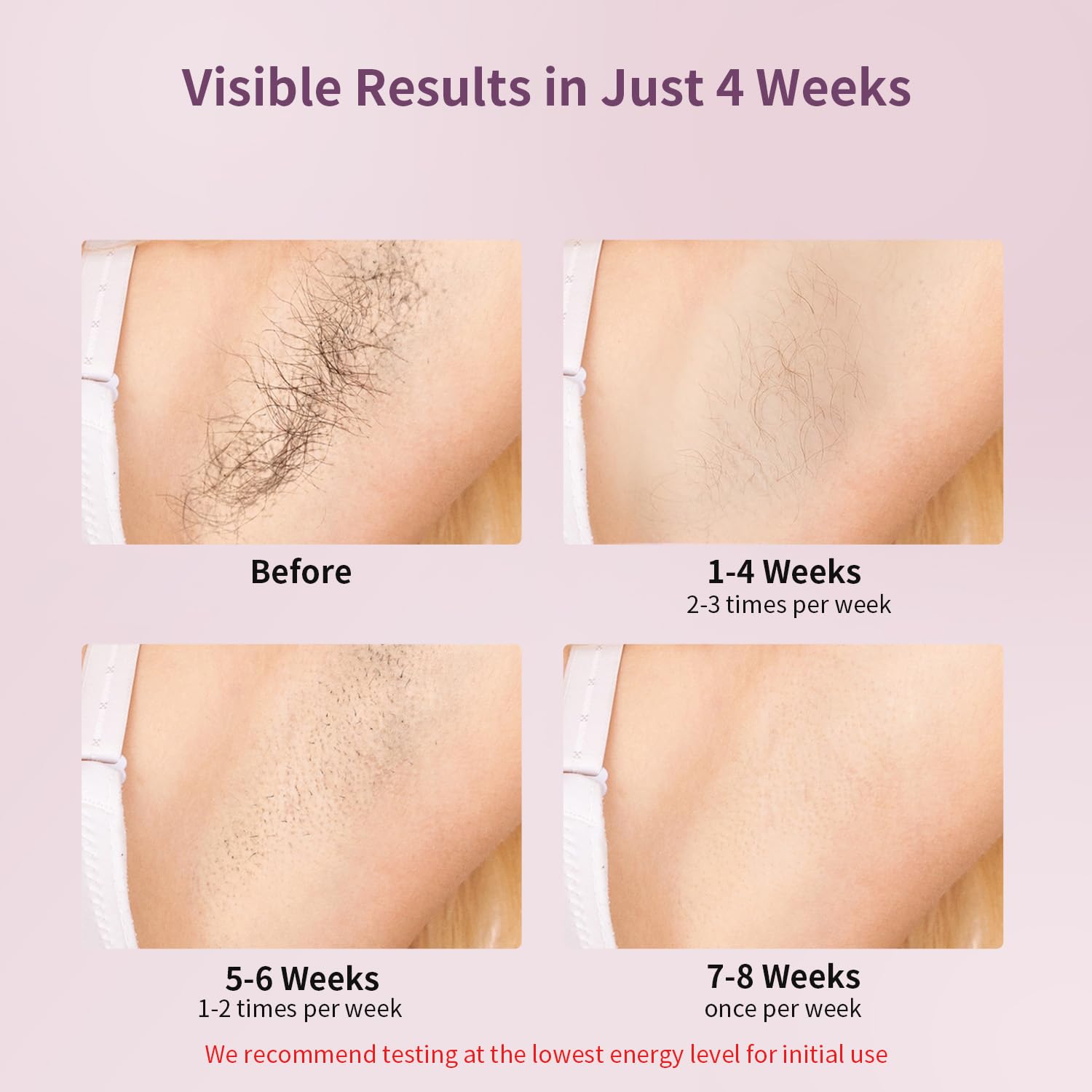 MLAY IPL Laser Hair Removal, Hair Removal Device with Ice Cooling Painless Hair Removal for Women & Men, Permanent Hair Removal at Home for Arms Armpits Face Legs Bikini Line, 5 Energy Levels, 2 Heads | T14 Hair Removal 1,500,000 Flashes Permanent Hair Removal at Home for Arms Armpits Face Legs Bikini Line, with HR BK FC Heads - Image 4