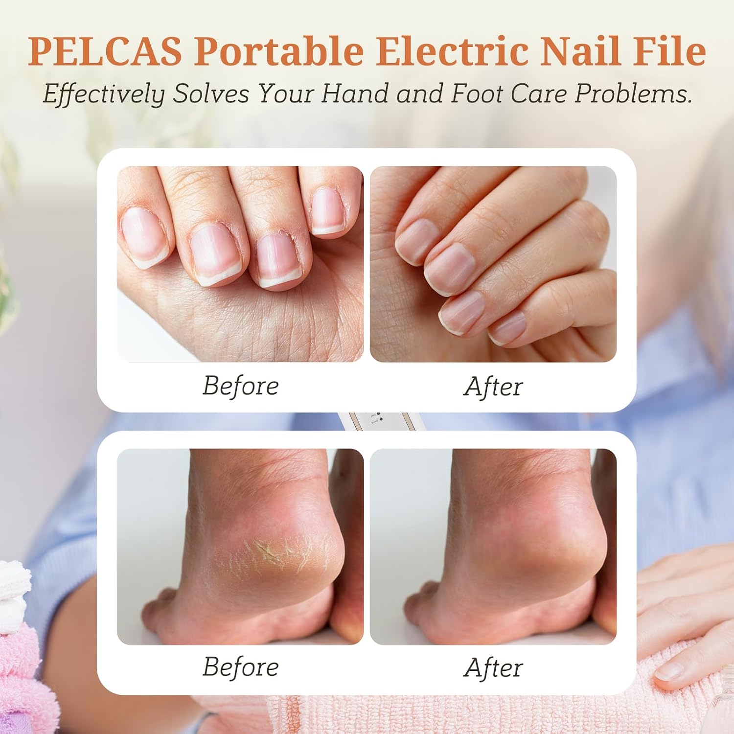 PELCAS Electric Toenail Grinder for Thick Toenails, 5 Speeds & LED Light | Manicure and Pedicure Kit, Cordless Nail Drill, Electric Nail File for Human, Pet, Thick Toenails, Natural & Acrylic Nails - Image 2