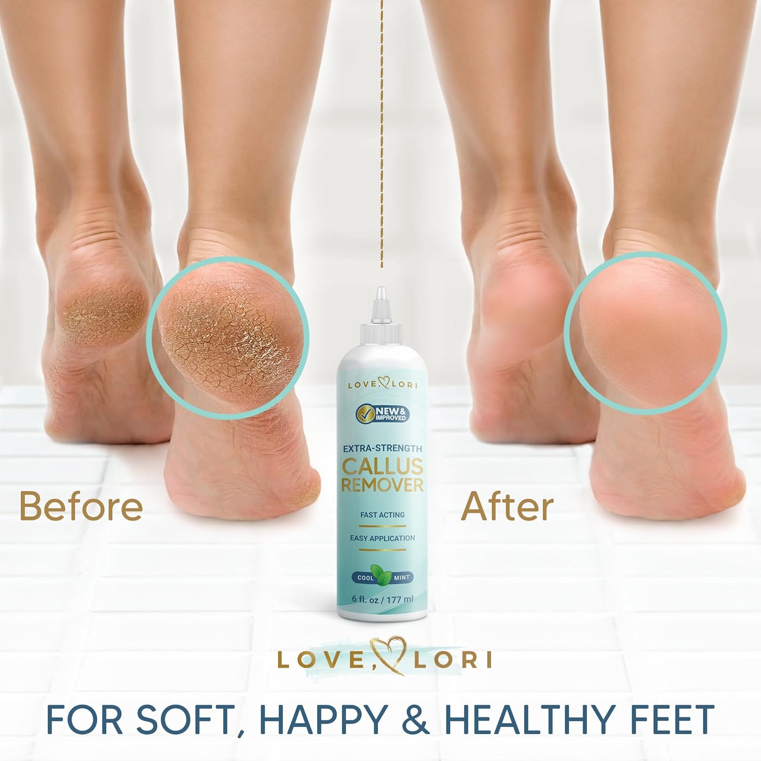 Love Lori Foot Callus Remover Gel Extra Strength Pedicure Tool for Feet 6oz | Quickly, easily, softens and removes dead, hard skin on heels & feet; salon-quality pedicure results at home - Image 3