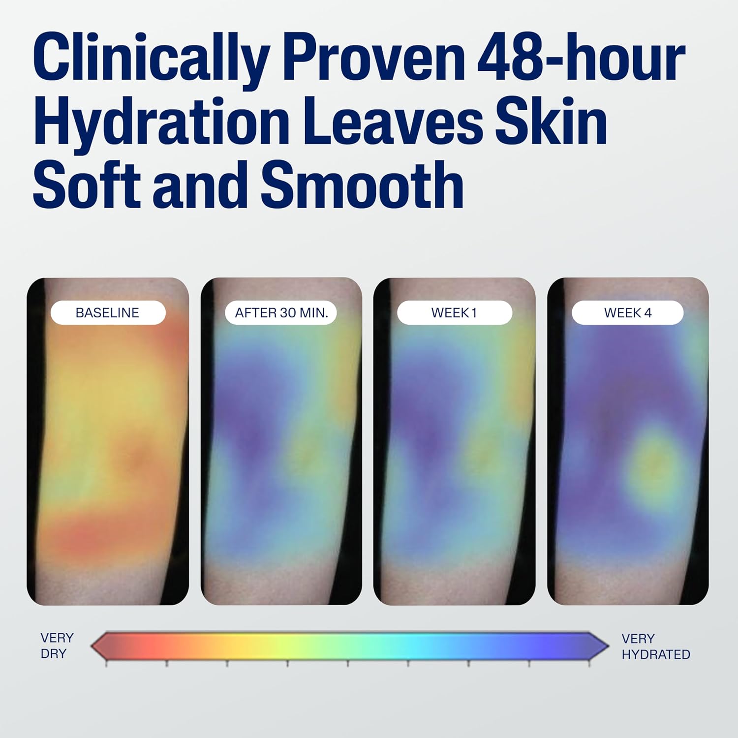Cetaphil Moisturizing Face & Body Lotion, Sensitive Skin, 20oz | Fragrance-Free, Hypoallergenic, Non-Comedogenic, Hydrates Dry Sensitive Skin, Dermatologist Recommended, Large 20 Oz - Image 5