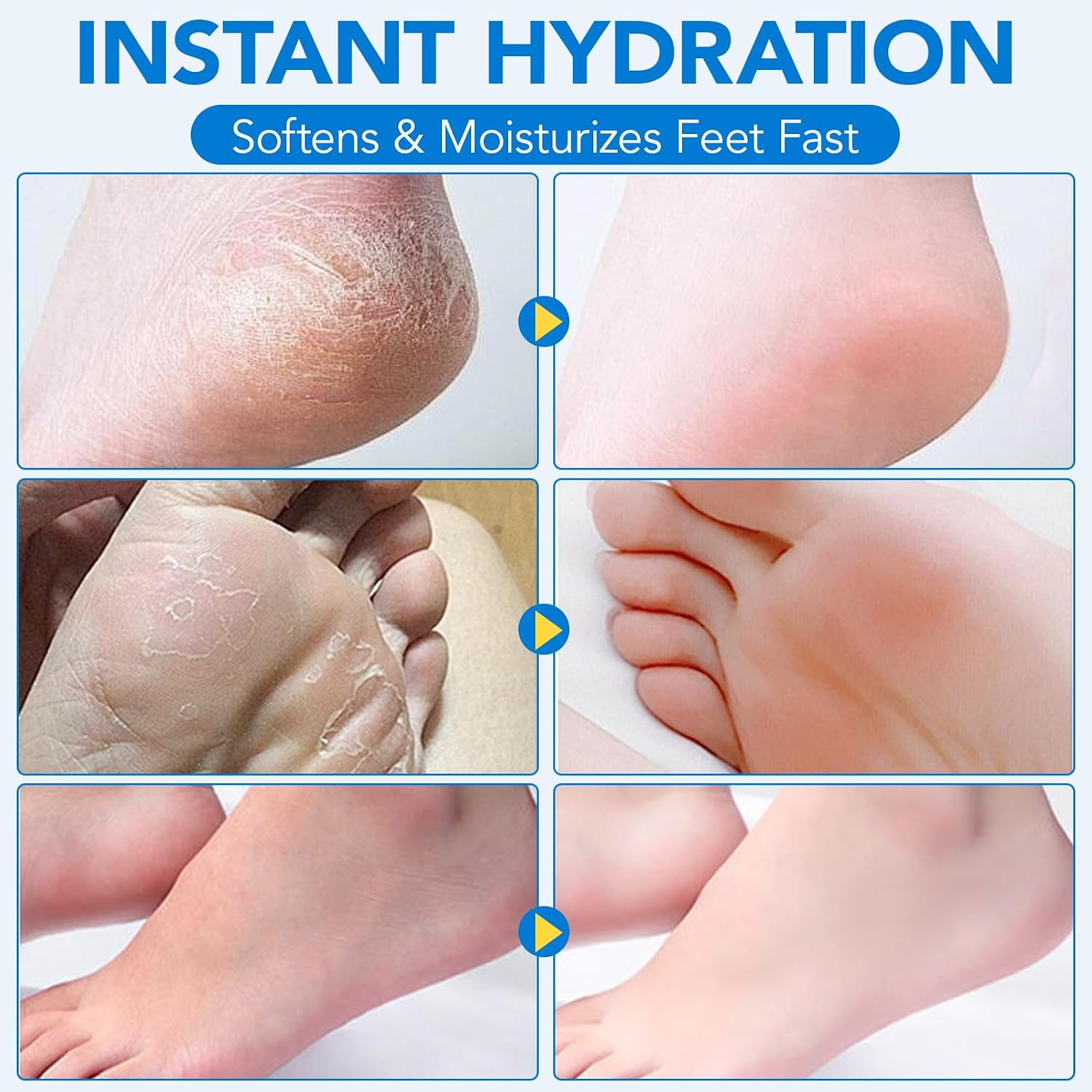 Uruses Urea Cream 60% plus Salicylic Acid 2% Urea Foot Care Stick, Foot Cream for Foot Callus Remover, Feet Moisturizer Stick for Dry Cracked Heels, Hands, Knees, Hydrating Heel Balm, Easy To Use - Image 7