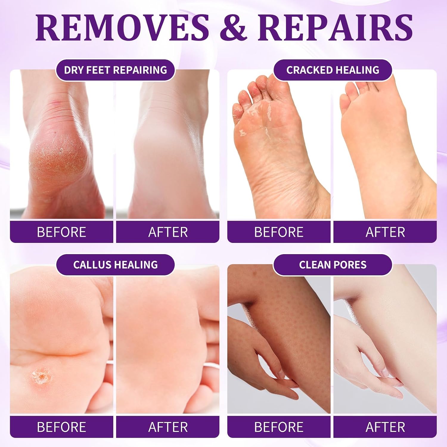 Pedicure Kit Foot Soak Set: Bubble Salt, Sugar Scrub, Massage Mask, Massage Lotion in a Box, 4 Step Foot Spa Kit for Dry Feet, Softens Calluses, Tired Feet(3 Set Lavender) - Image 3