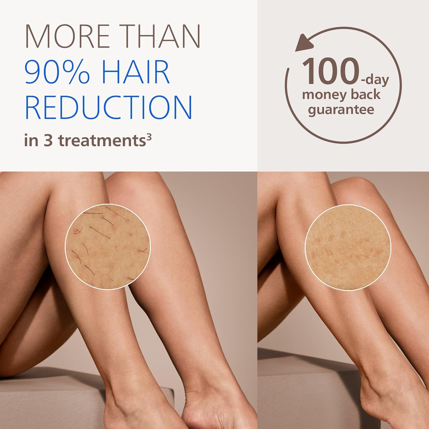 Philips Lumea IPL — Salon-Like Laser Hair Removal for Women, Permanent Hair Reduction Device At Home for Face & Body — Safe & Painless for Face, Bikini, Body, 5 Settings & Skin Sensors, BRI937/03 - Image 3