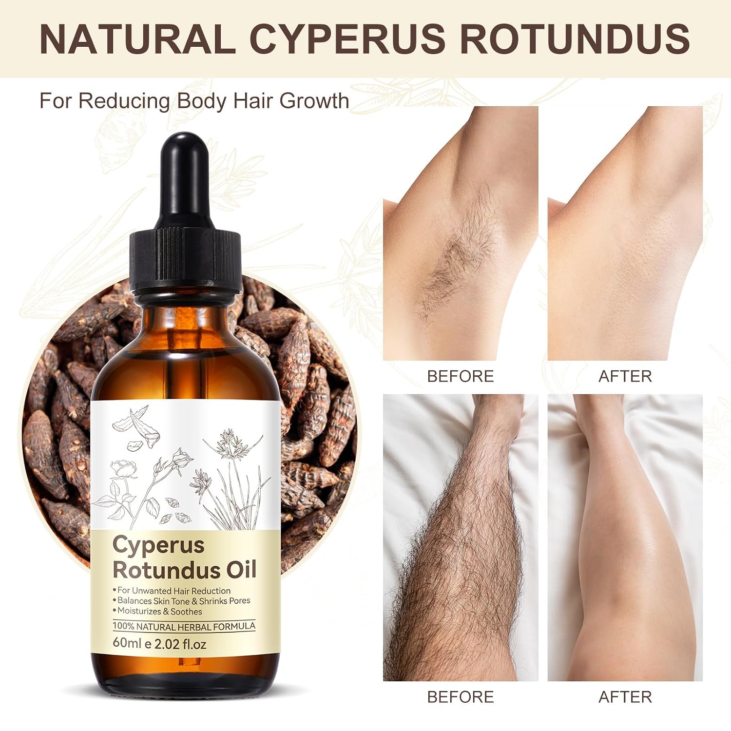 Premium Cyperus Rotundus Oil 2PCS - Reducing Body Hair Growth | 100% Pure Cyperus Rotundus Essential Oil for Smooth Skin & Hair Removal, 60ml - Image 4
