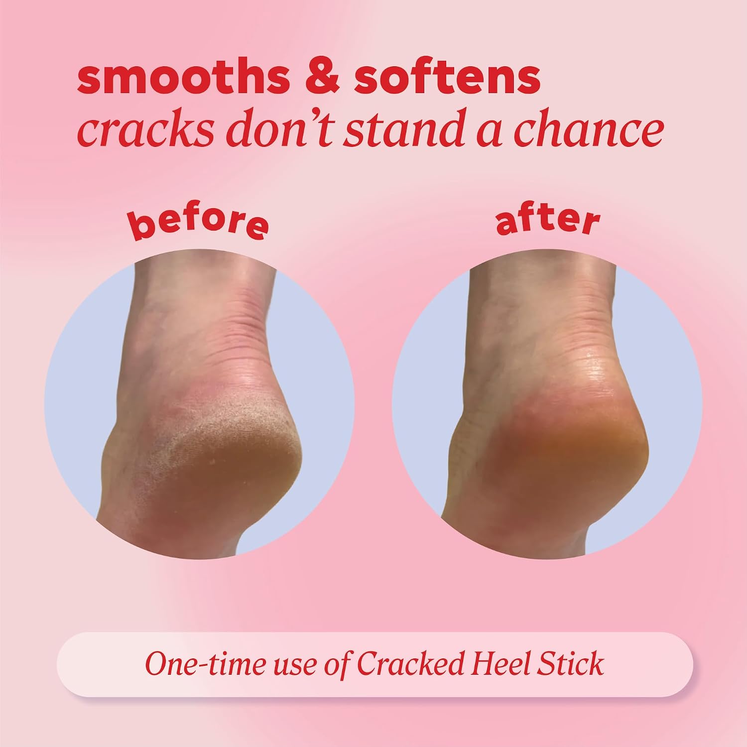 Onyx Professional Cracked Heel Repair Balm Stick for Dry Cracked Feet Treatment, Coconut Scent, 1 pack - Moisturizing Foot Balm, Rolls On, Cracked Heel Treatment - Image 4