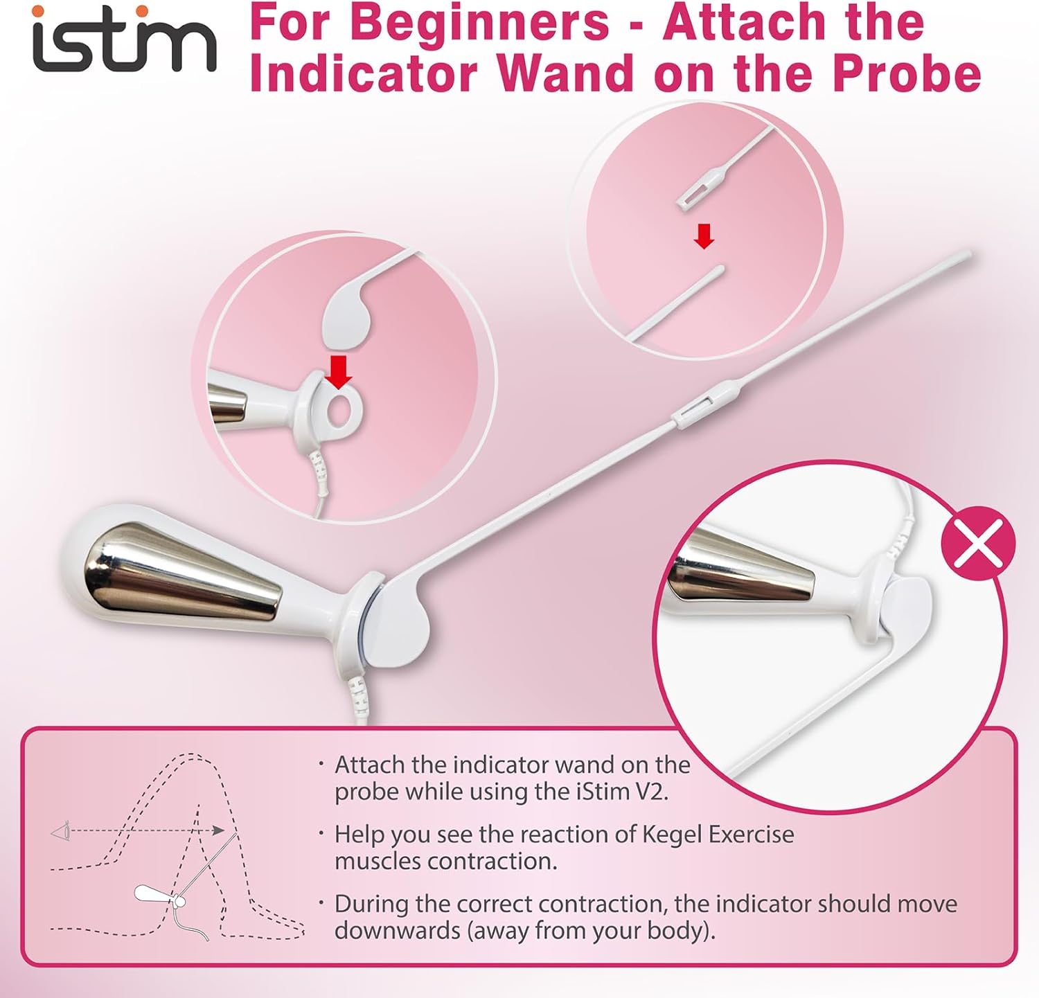 Everyway Incontinence Stimulation System - iStim V2 Kegel Exerciser - Electrical Muscle Stimulator for Pelvic Floor Muscle Rehabilitation and Urinary Incontinence in Women - Image 3