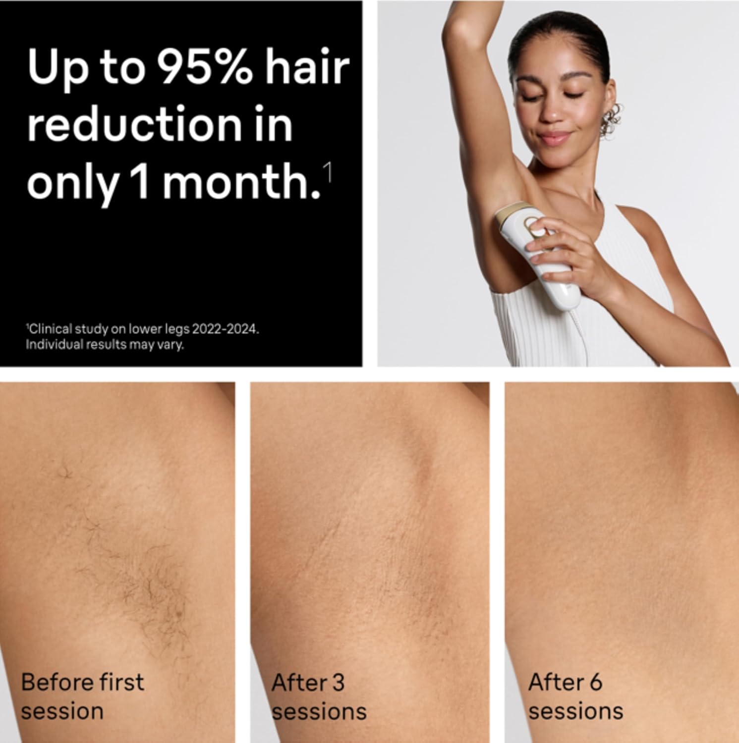 Braun IPL, Silk·Expert Pro 5, IPL Hair Removal for Women and Men, Permanent Laser Hair Reduction At-Home, 2 Heads, Pouch, Venus Razor, IPL5157 - Image 3