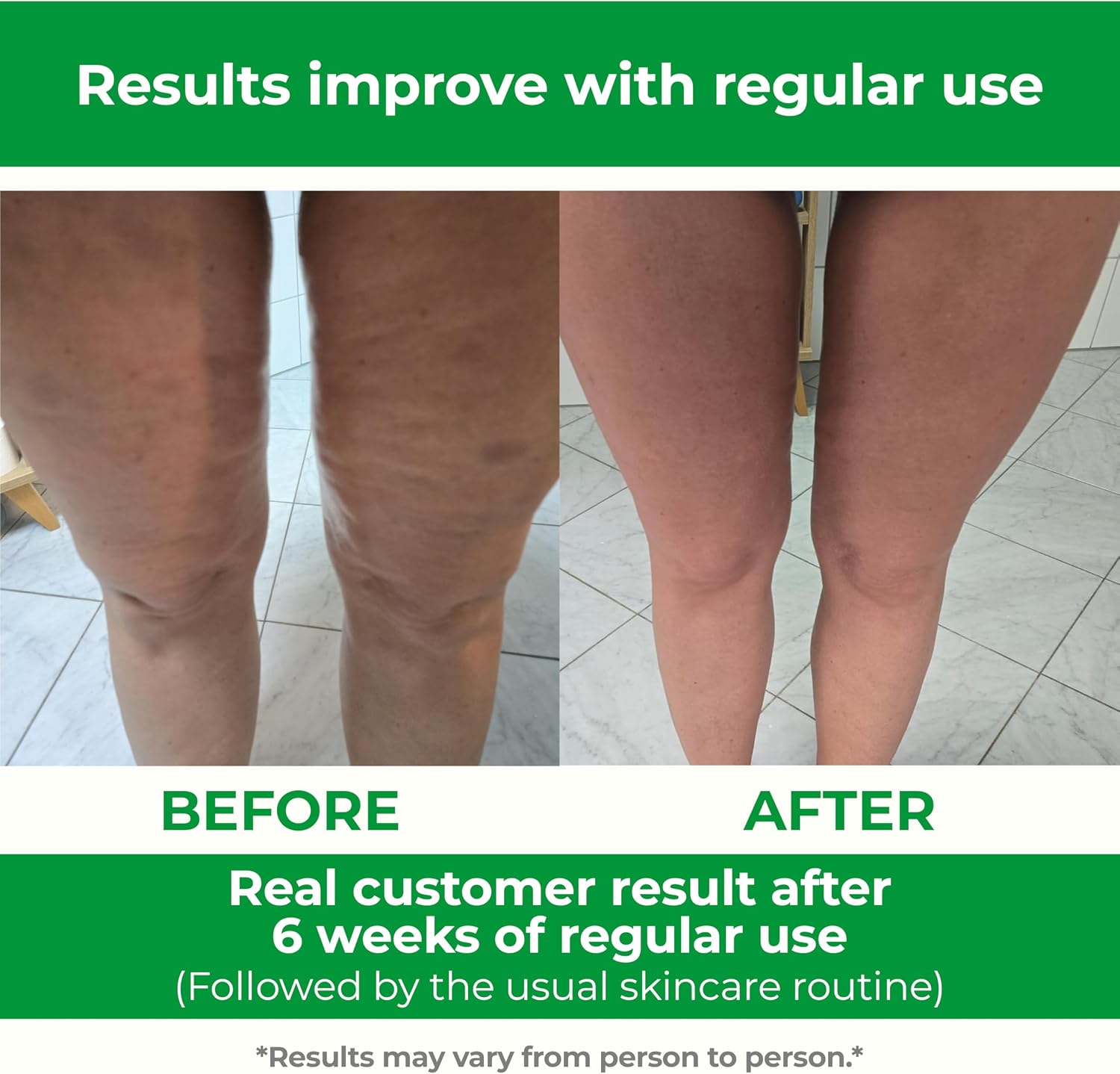 TESMED Cellulite Manual Massager Roller for Thighs and Buttocks | Made in Italy and patented, with converging and diverging roller technology for targeted anti-cellulite massage. - Image 4