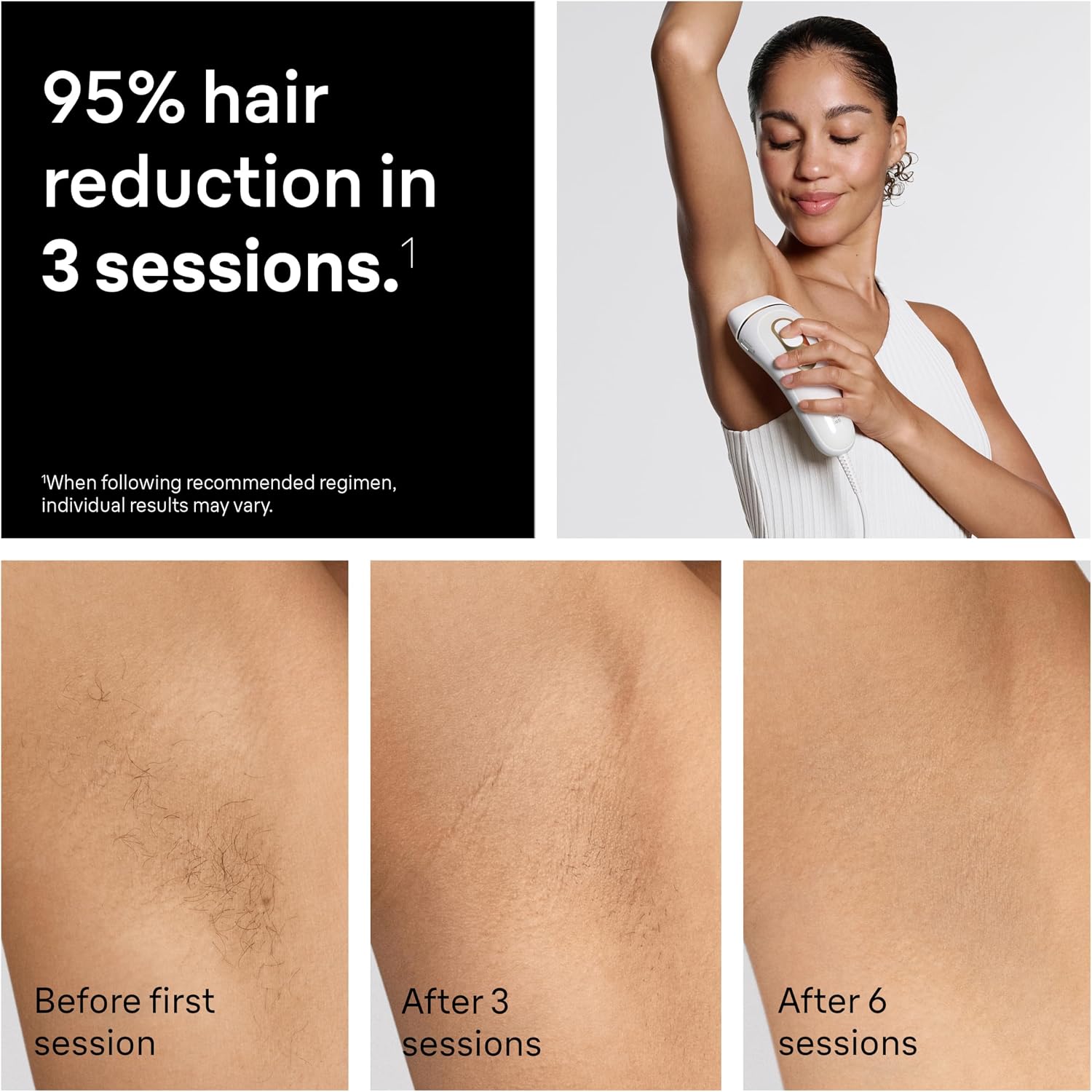Braun IPL, Silk·Expert Pro 5, IPL Hair Removal for Women and Men, Permanent Laser Hair Reduction At-Home, 1 Head, IPL5100 - Image 4
