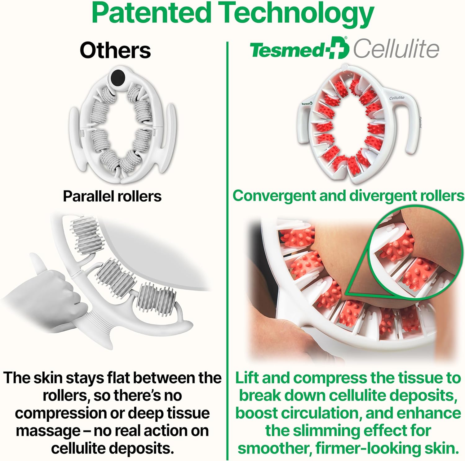 TESMED Cellulite Manual Massager Roller for Thighs and Buttocks | Made in Italy and patented, with converging and diverging roller technology for targeted anti-cellulite massage. - Image 6