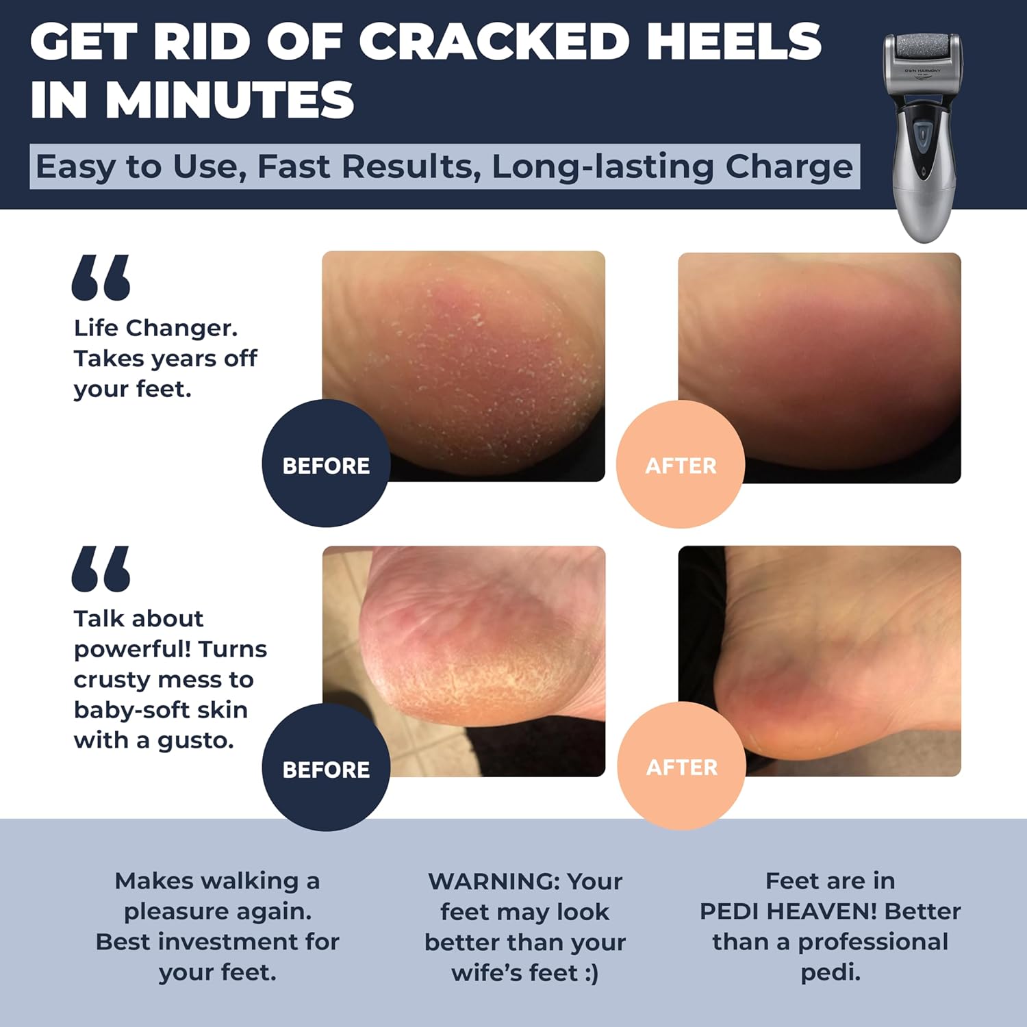 Own Harmony Electric Callus Remover - Rechargeable Foot File Pedicure Tool | Professional Foot Callus Grinder, Cordless, 3 Rollers, USB Cable, Water-Resistant, for Cracked Heels and Dry, Hard, Dead Skin - Image 2