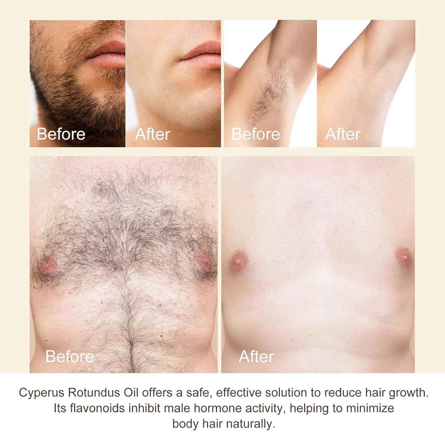 Cyprus Rotundus Oil for Hair Removal - Reducing Body Hair Growth | 100% Pure Cyperus Rotundus Essential Oil for Smooth Skin & Hair Removal, 60ml - Image 6