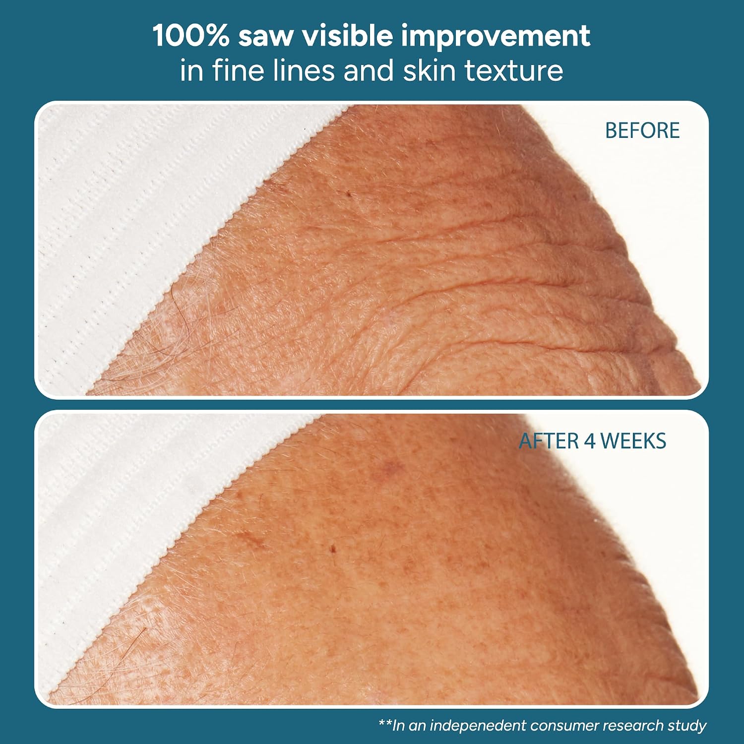 Lancer Skincare | The Method: Nourish Face Moisturizer | 1.7fl oz | Anti Aging Face Cream | Lightweight Hydration | Hyaluronic Acid | For Normal or Combination Skin | Dermatologist Developed - Image 3