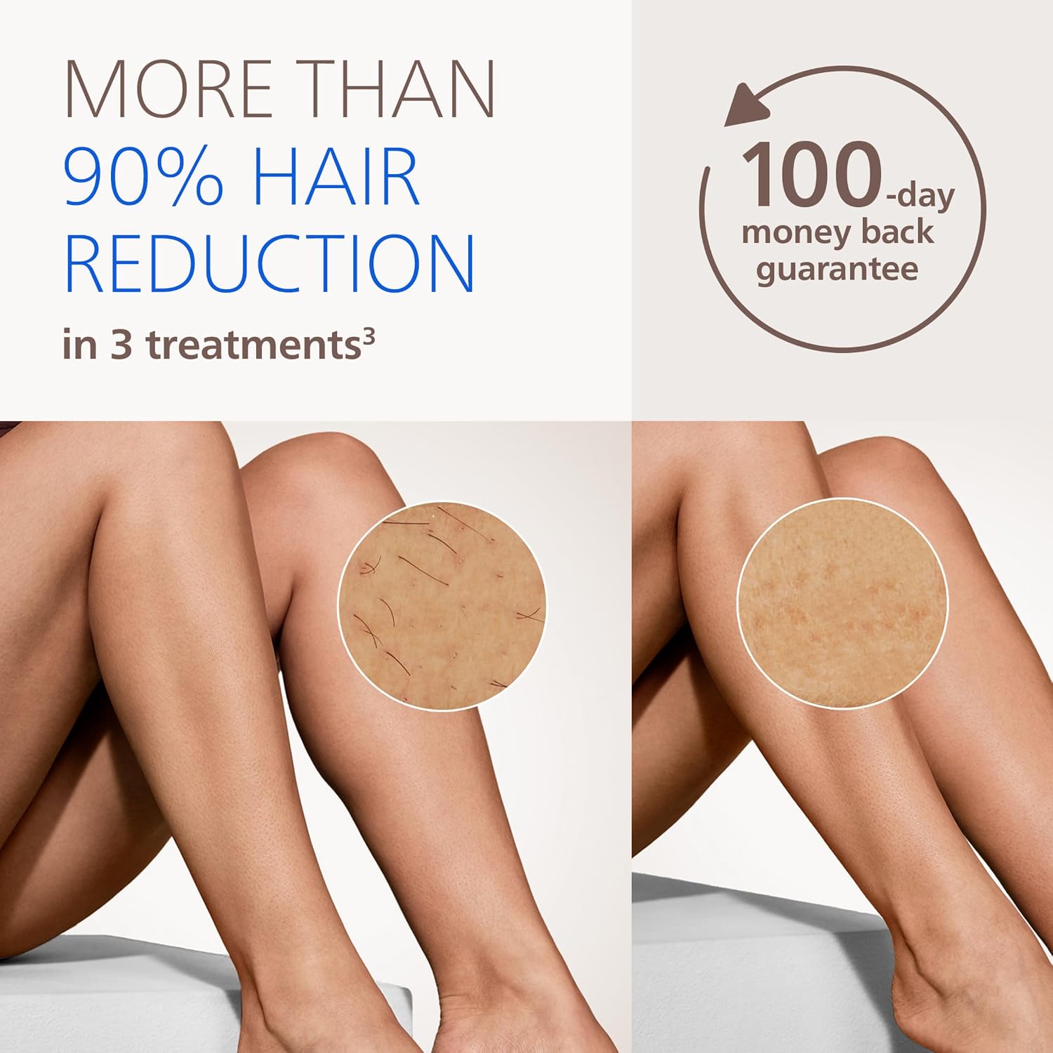 Philips Lumea IPL — Salon-Like Laser Hair Removal for Women, Permanent Hair Reduction Device At Home for Face & Body — Safe & Painless for Face, Bikini, Body, 5 Settings & Skin Sensors, BRI984/03 - Image 3
