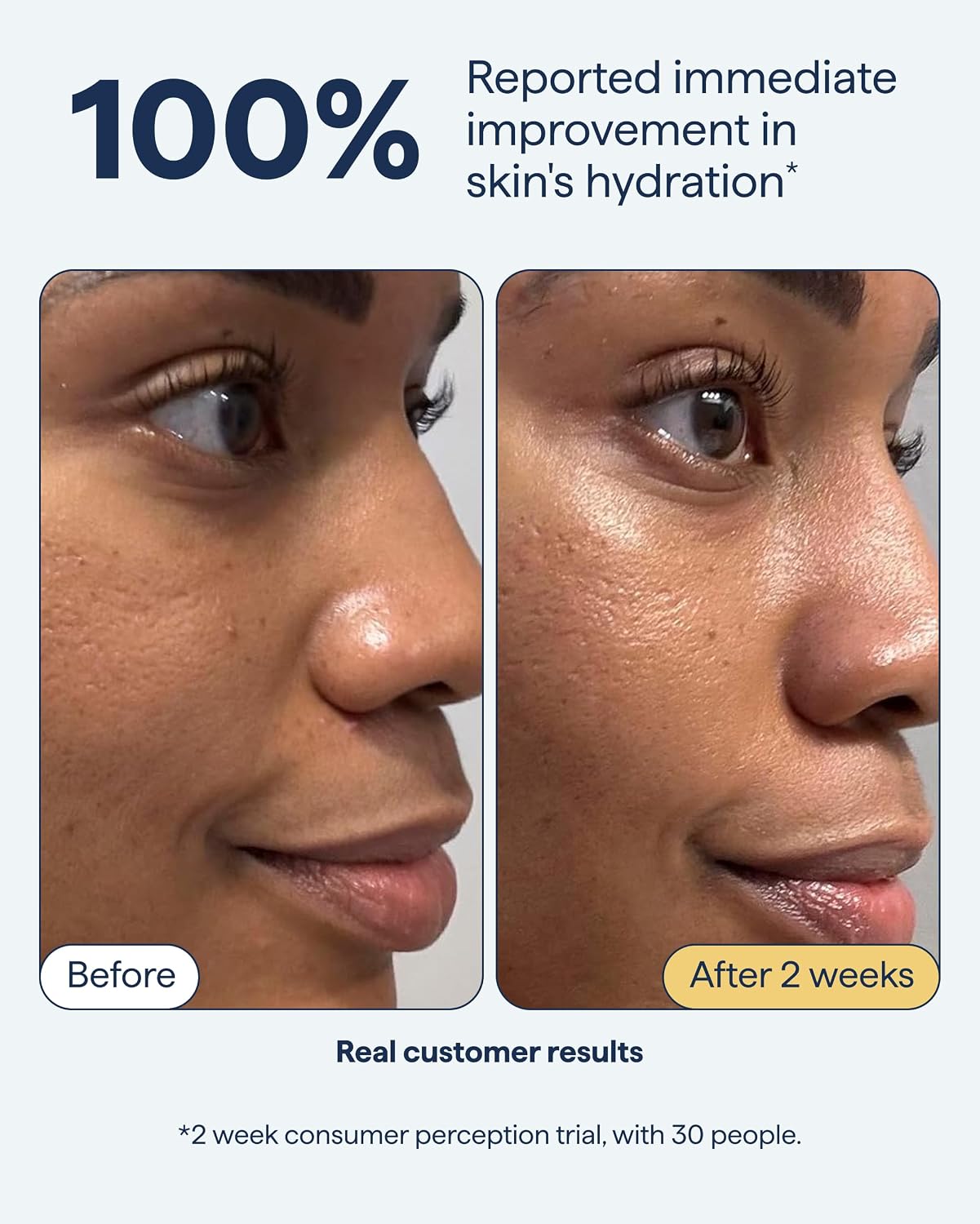 REMEDY Rich Barrier Repairing Cream Face Moisturizer for Dry Sensitive Skin | Quadruple Ceramide Complex, Peptides and Squalane, Eczema Certified, Fragrance Free, By Dermatologist Dr. Shah, 1.7 fl oz - Image 4
