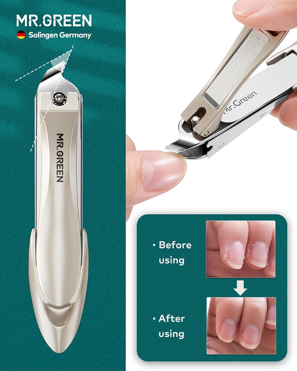 MR.GREEN 4Pcs Nail Clipper Set, Anti-Splash Upgraded Nail Clippers Kit | German Stainless Steel, Nail File+Tweezers Included, Unique Catcher, Exquisite Leather Case, for Men Women Home Travel Gift - Image 4