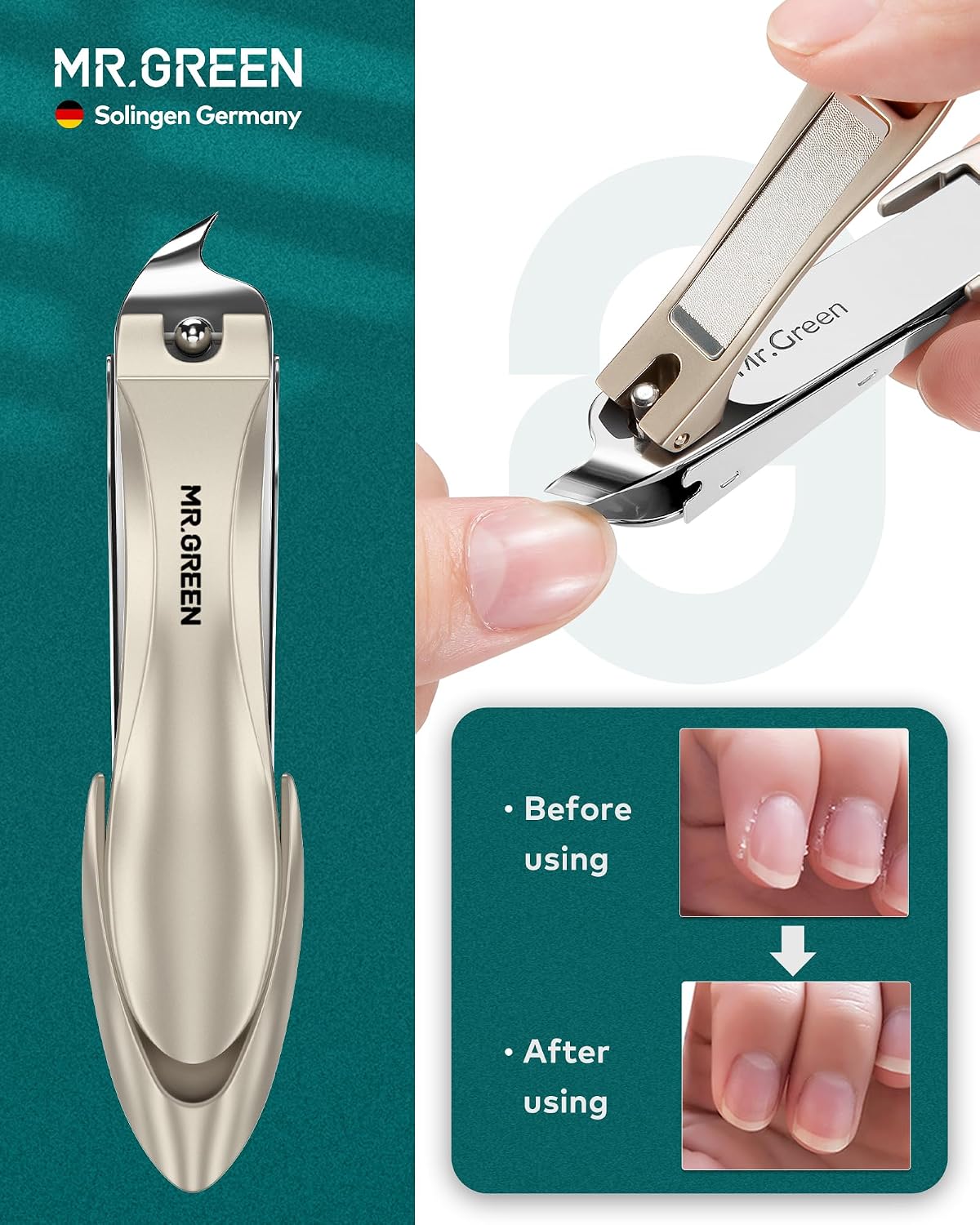 MR.GREEN Upgraded Manicure Set, German Stainless Anti Splash Nail Clippers Set with Cather, Quality Fingernail& Toenail Clipper, Professional Nail Care Kit with Exquisite Leather Case for Men & Women - Image 3